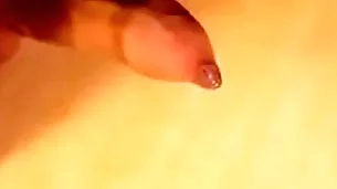Phimosis load of shit marvellous cumshot