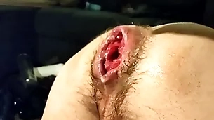 Unique fisting my profligate fissure with an increment of prolapse:)
